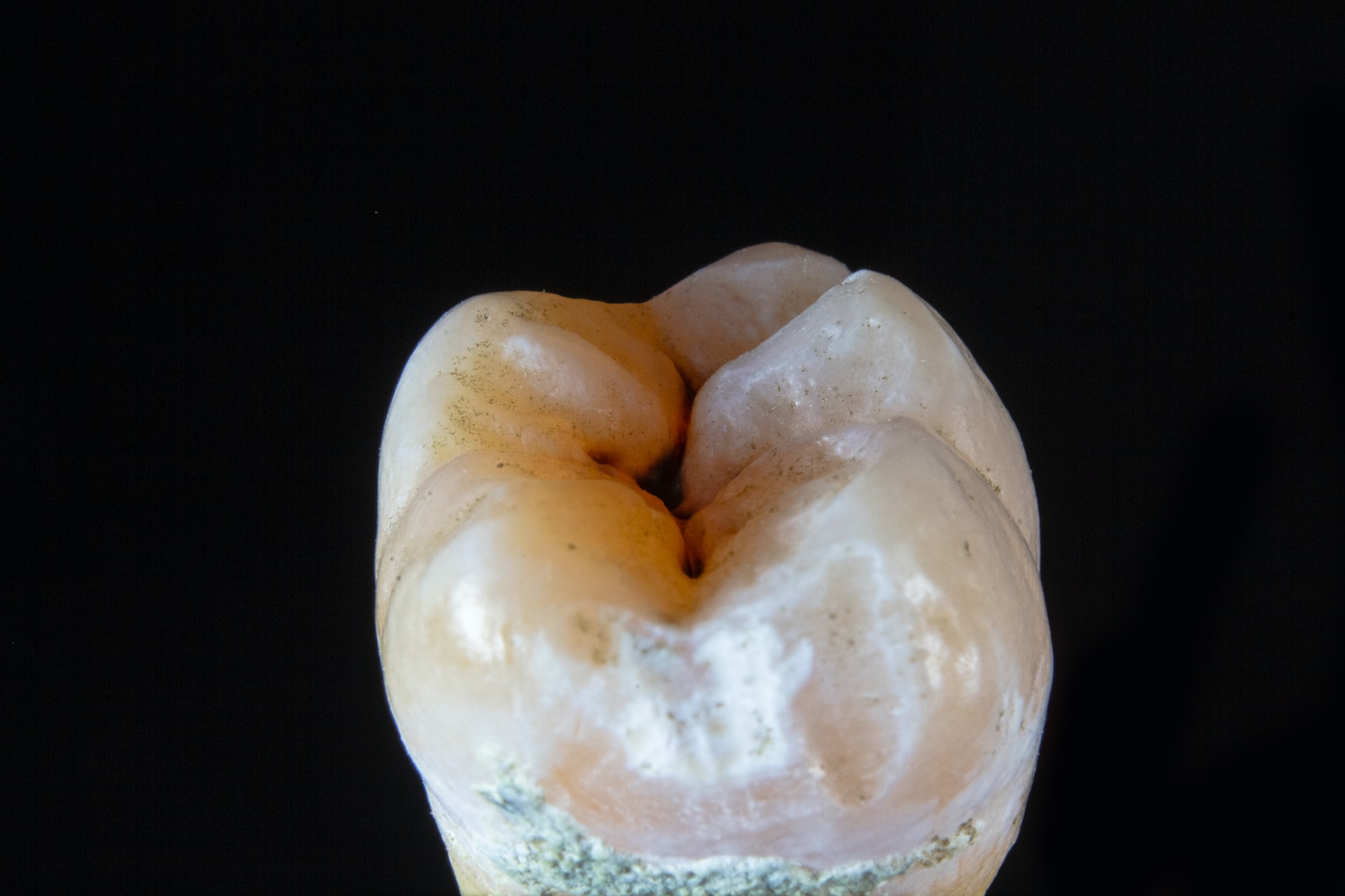 Krank durch Zähne: Symptome im Körper erkennen