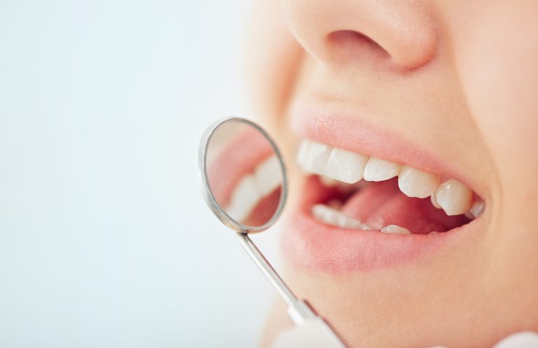 Warum werden Zähne transparent? – Ursachen & Behandlung